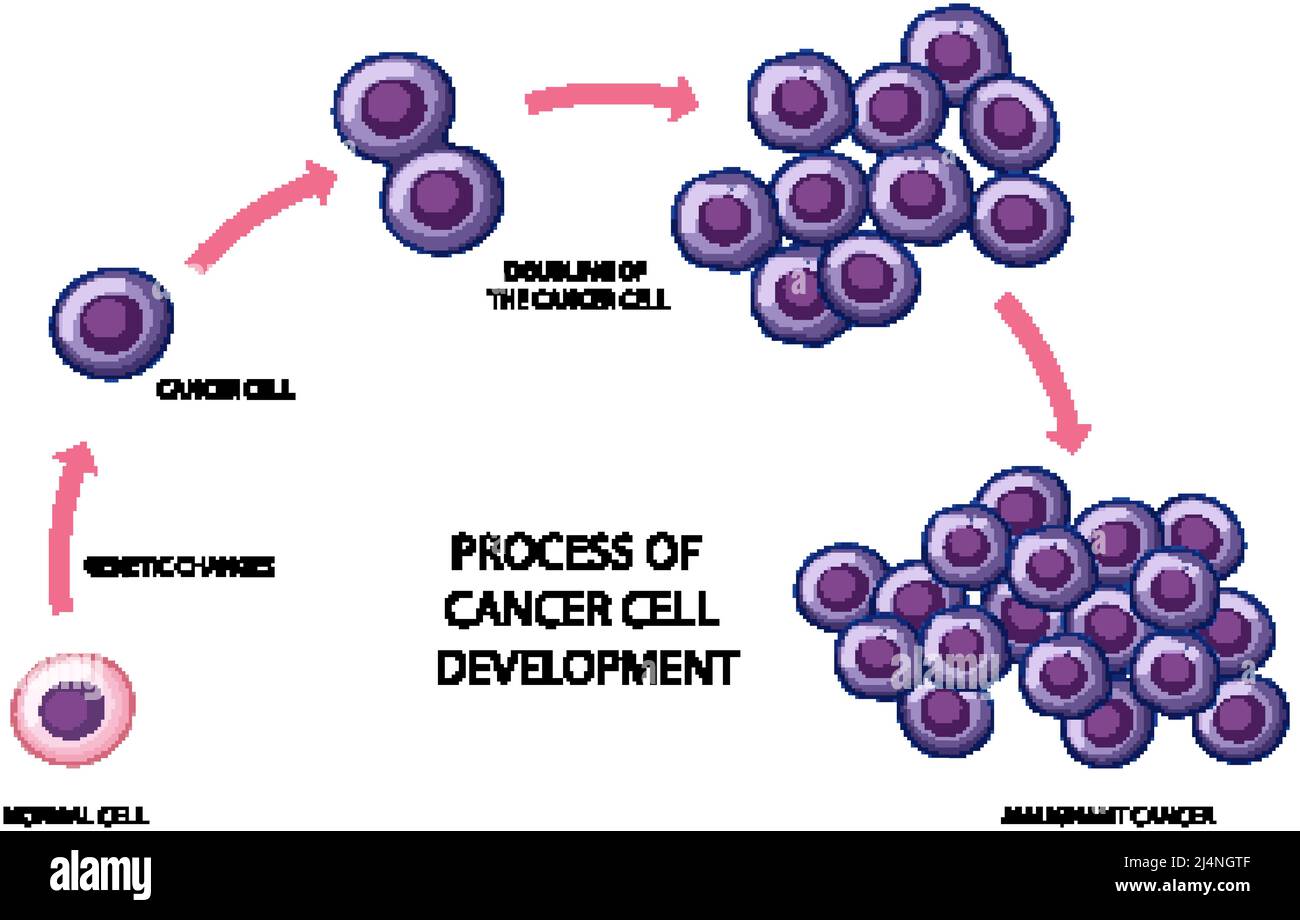 Process Of Cancer Cell Development Illustration Stock Vector Image