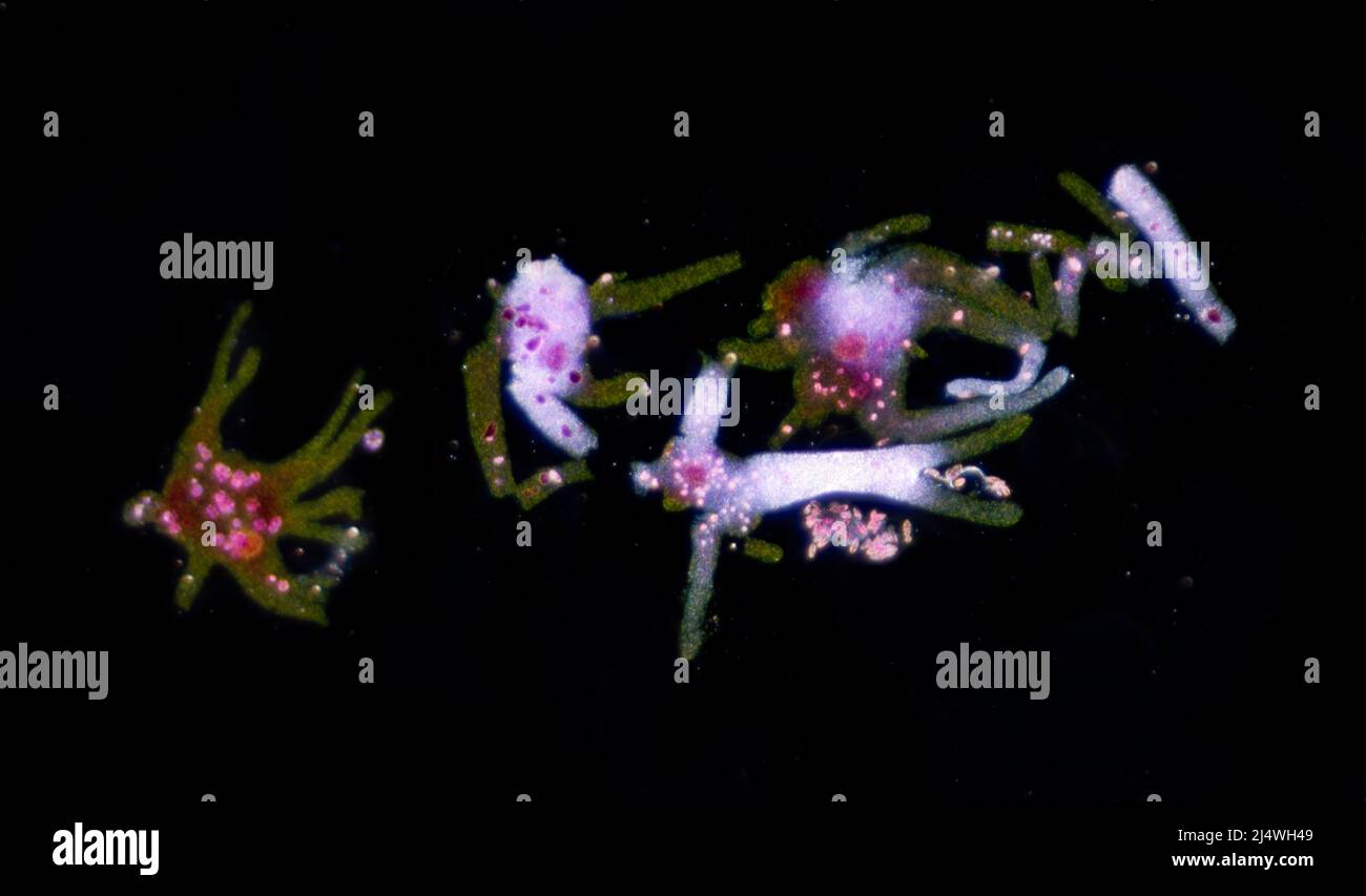 Amoeba Proteus, stained specimens, darkfield photomicrograph Stock Photo