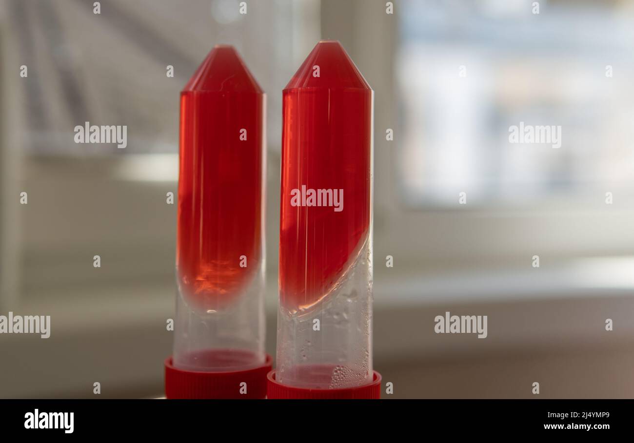 petri dishes with agar. Microbiology and mycelium Stock Photo Alamy
