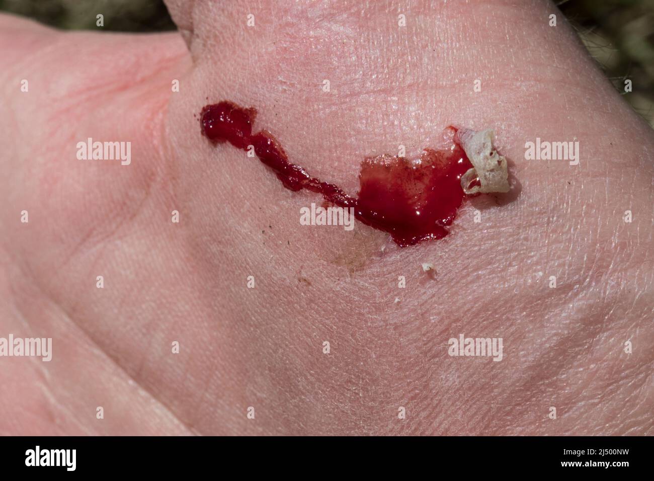 Cut on hand close up with scraped skin. Stock Photo