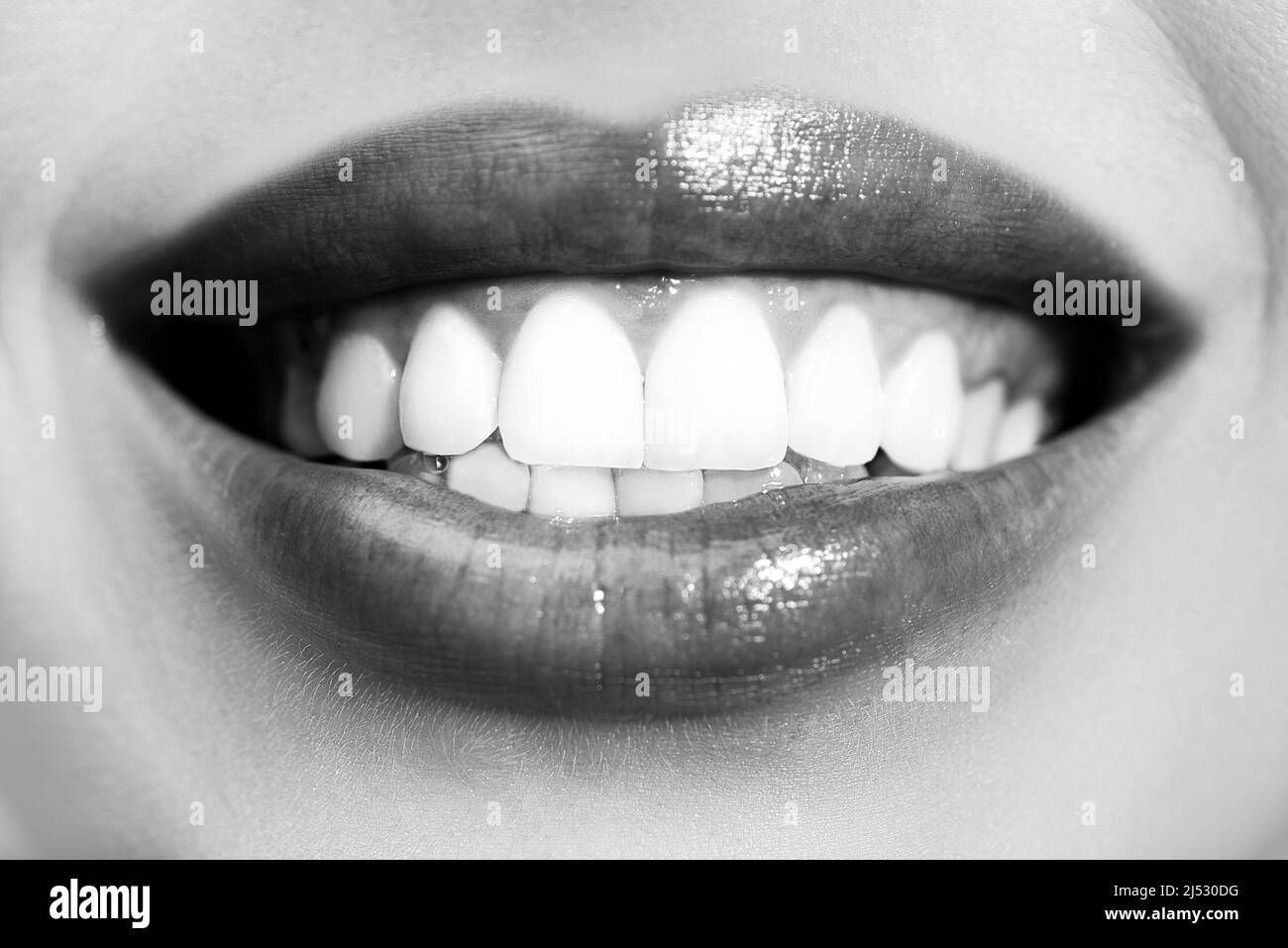 Laughing woman mouth with great teeth. Perfect smile after bleaching. Dental care and whitening teeth. Healthy smile, smaling. Stock Photo