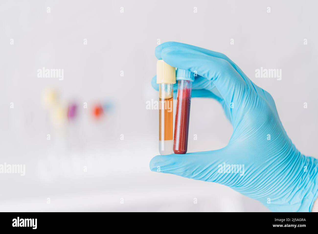 Hand holding two test tubes with blood and plasma against the