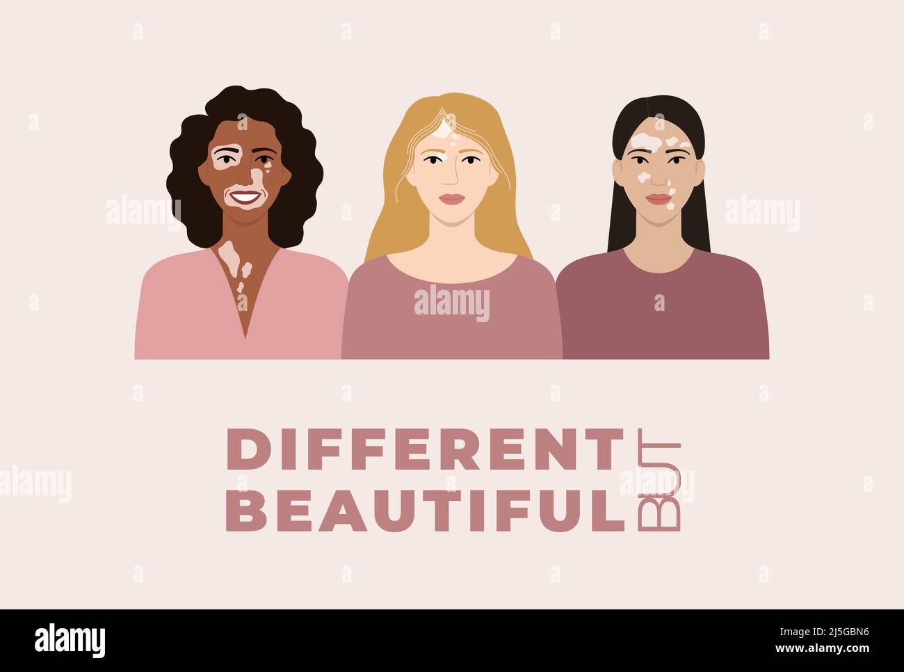 Female faces with vitiligo skin disease banner. Different but beautiful concept. Portraits with different ethnics, skin colors, hairstyles with vitili Stock Vector