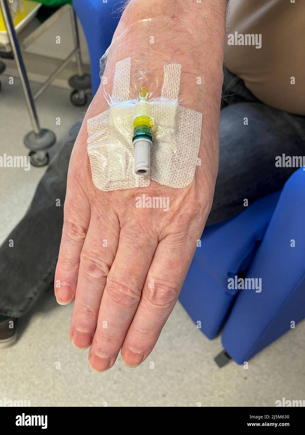 Male patient with Cannula inserted for chemotherapy drip infusion in medical hospital Stock Photo