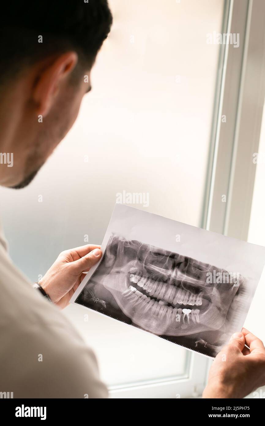 Dentist looking an X-ray of jaw teeth with an implanted tooth . Dentist services concept Stock Photo