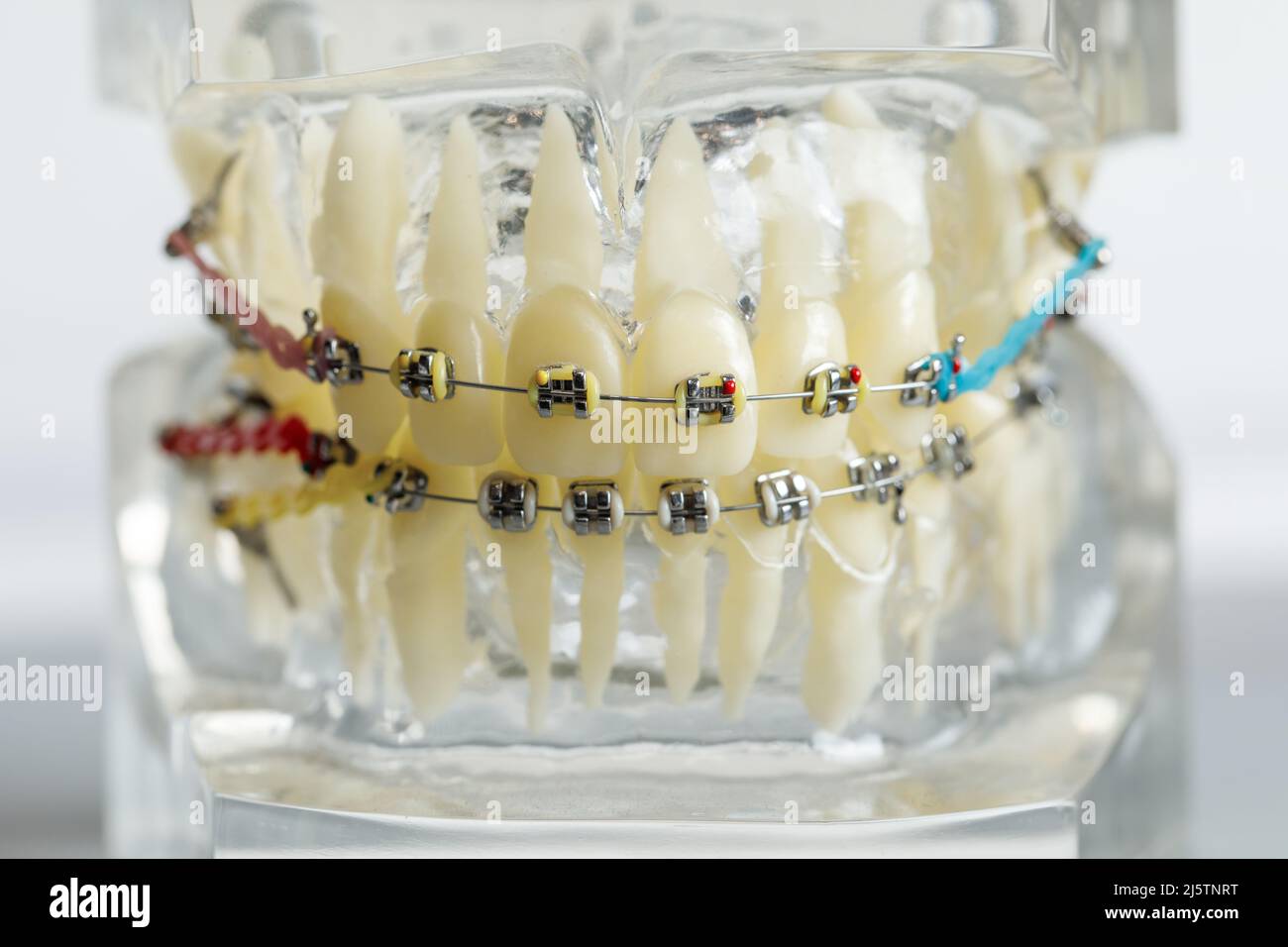 Mould of human teeth close up. dental gypsum model. Plaster cast human jaws prosthetic laboratory. Dentistry teeth care imag Stock Photo