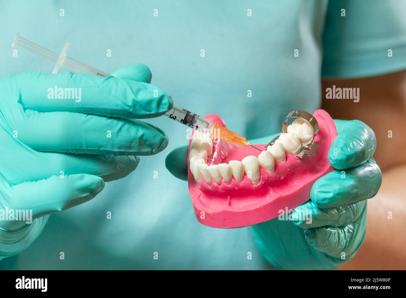 Dentist with layout of the human jaw and syringe Stock Photo - Alamy