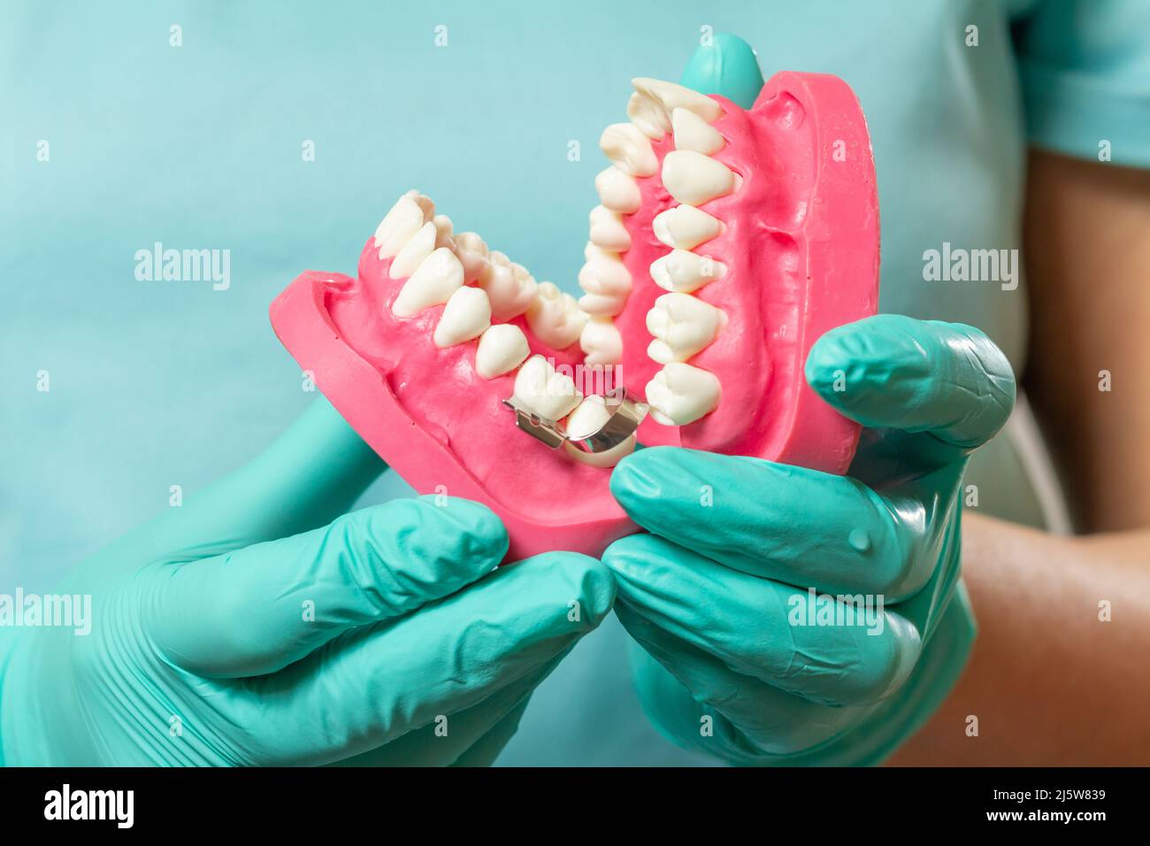 Dentist holding a layout of the human jaw Stock Photo - Alamy