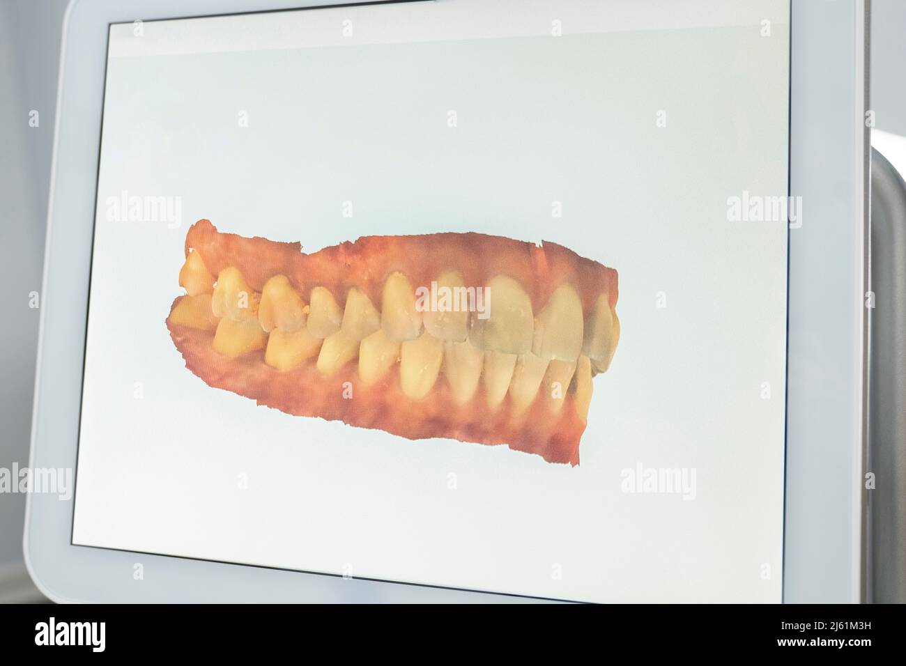 Scanned image of teeth on monitor screen at dental clinic Stock Photo