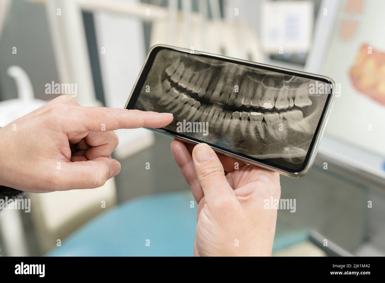 Dentist examining xray image on mobile phone Stock Photo Alamy