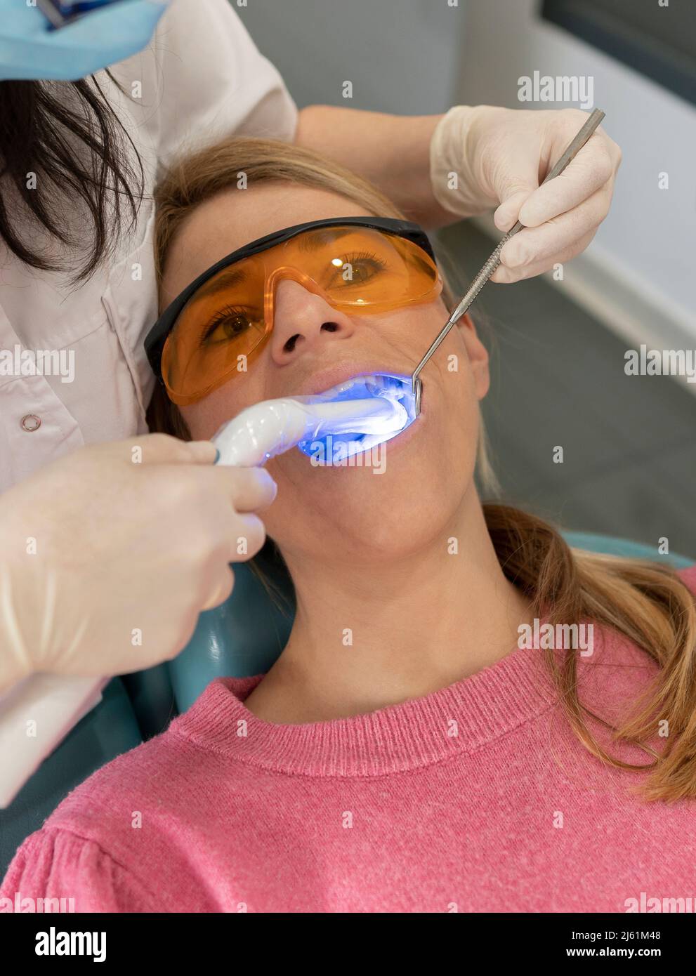 Dentist drying dental filling with curing light at medical clinic Stock
