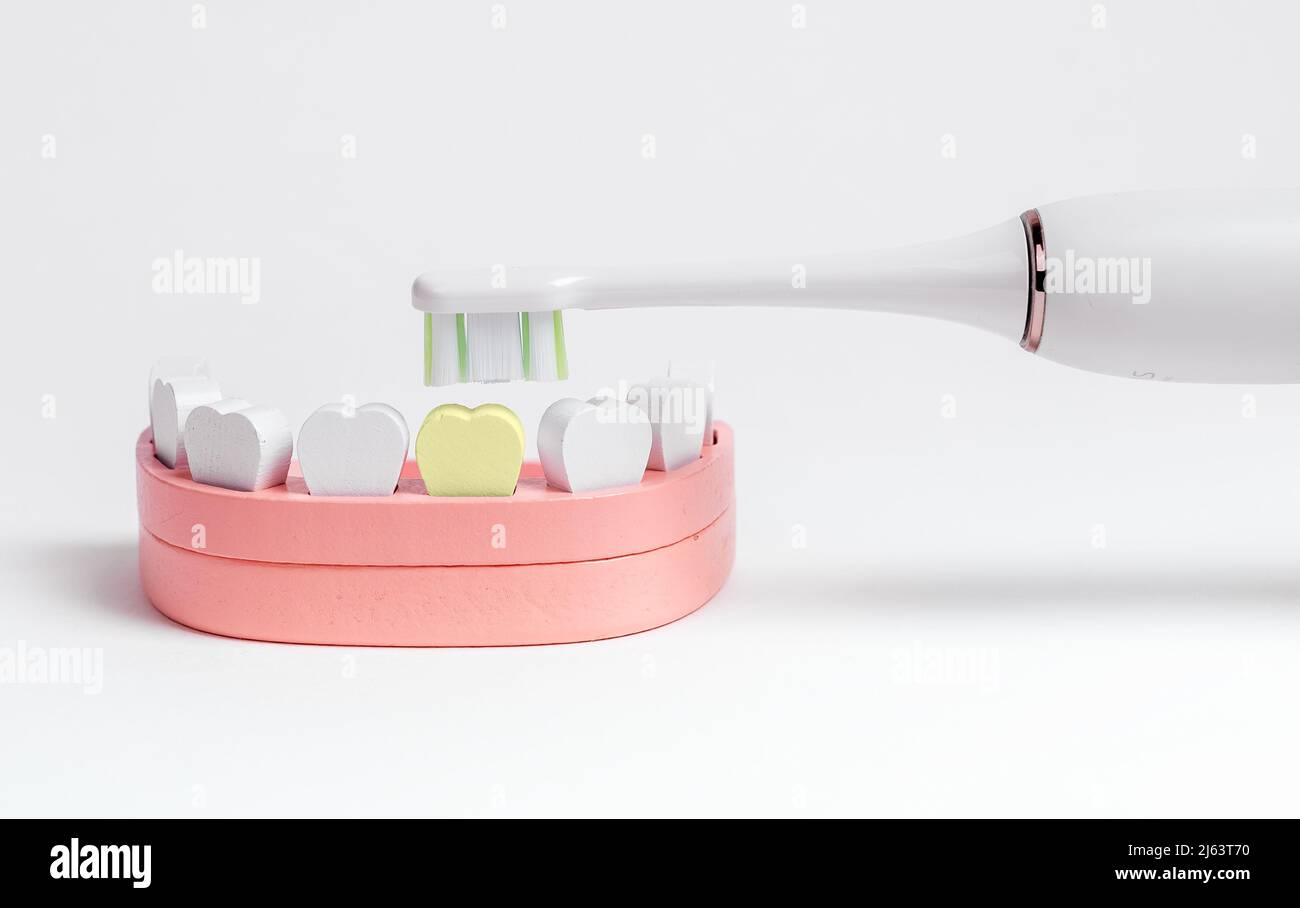 Electric toothbrush brushing tooth with caries, plaque in jaw model