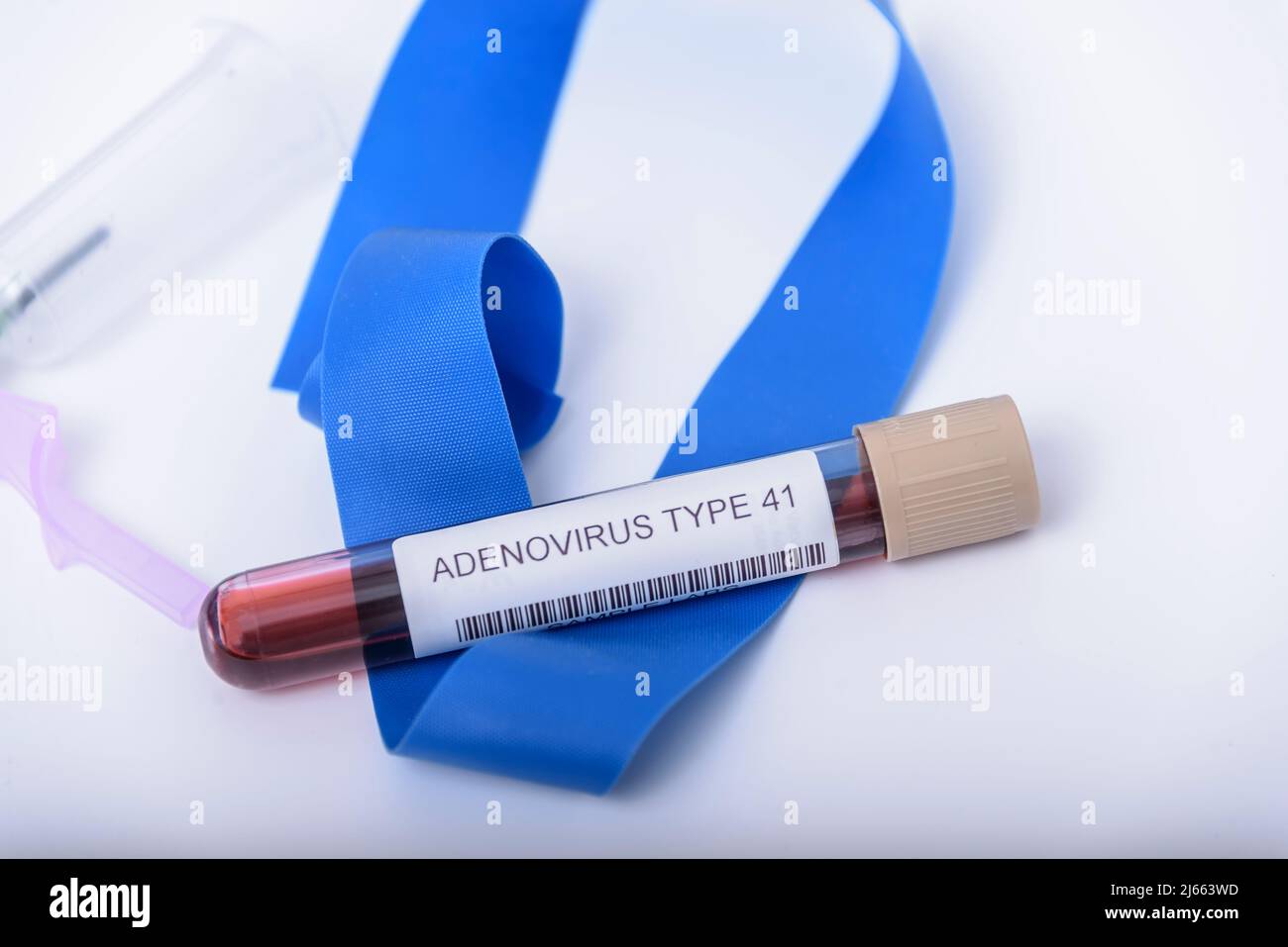 Childhood hepatitis. Blood sample tube for Adenovirus and Norovirus DNA