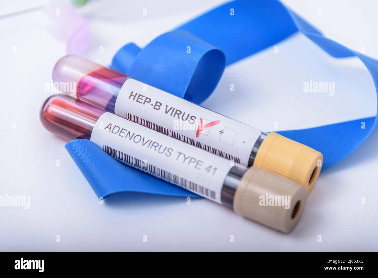 Suspected adenovirus as a culprit in childhood hepatitis of unknown origin. Hepatic, sars-cov2. Stock Photo