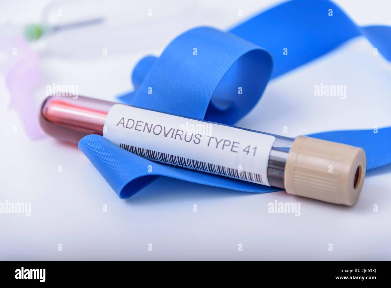 Childhood hepatitis. Blood sample tube for Adenovirus and Norovirus DNA
