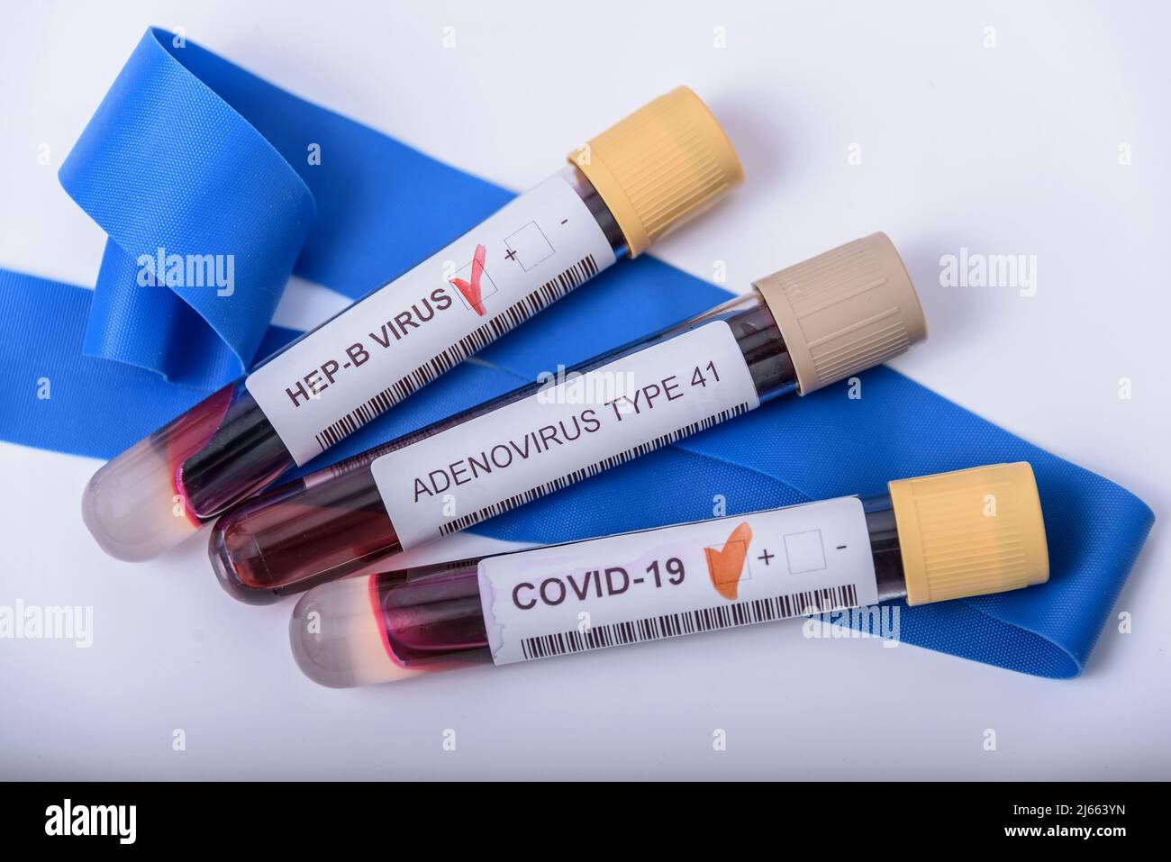 Suspected adenovirus as a culprit in childhood hepatitis of unknown origin. Hepatic, sars-cov2. Stock Photo