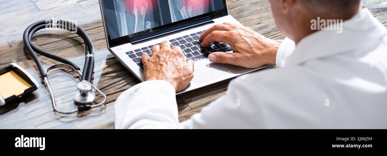 Doctor Looking At Foot X-ray On Laptop With Stethoscope Stock Photo