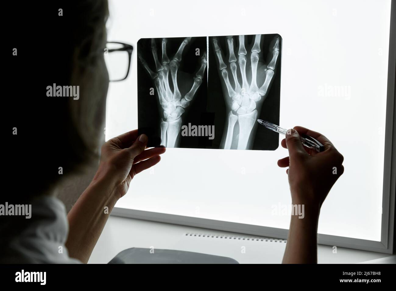 Surgeon Traumatologist examining an xray of the traumatised wrist. Health care and medical