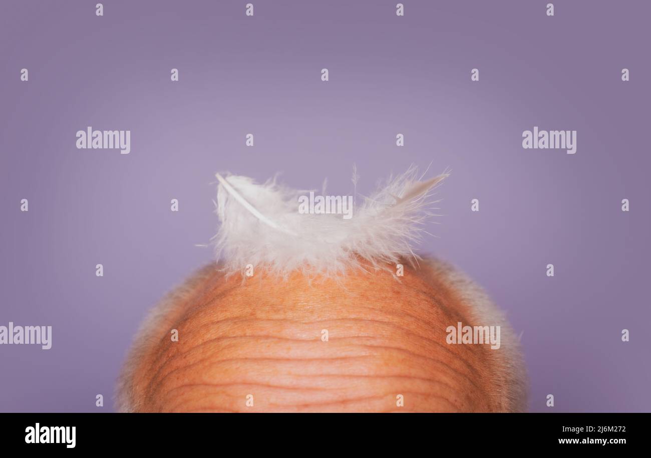 Hair Loss Health Issues: Unveiling Underlying Conditions