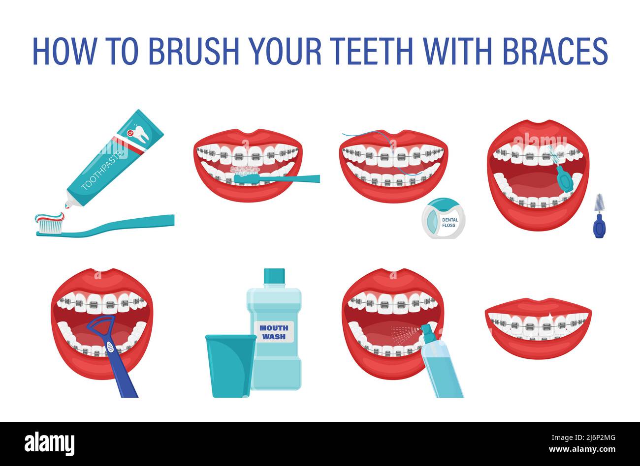 Infographic how to brush your teeth with braces. Step-by-step instructions. Oral hygiene. Healthy lifestyle and dental care. Clean white teeth. Preven Stock Vector