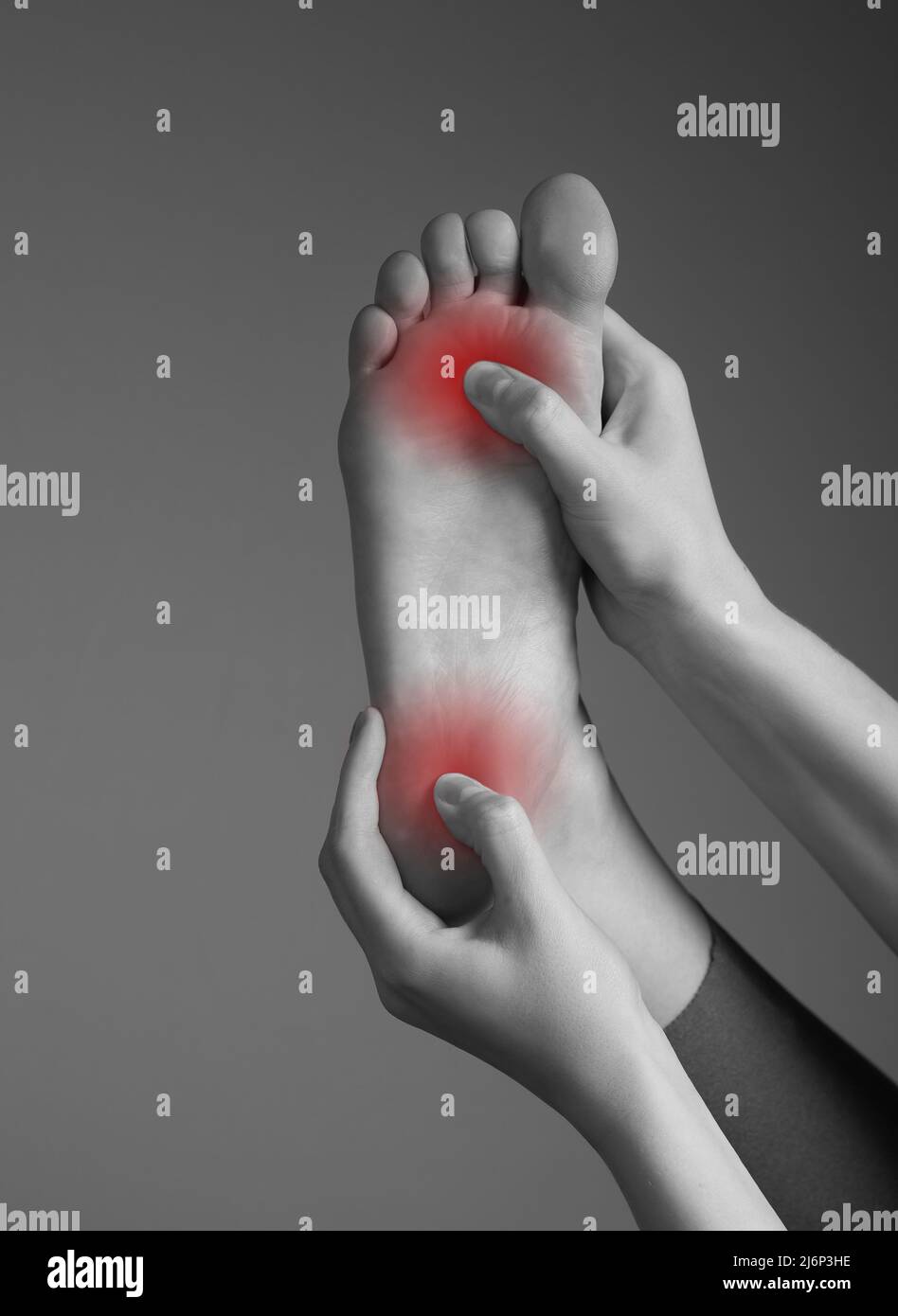 Toe and heel pain caused by plantar fasciitis, arthritis, diabetes, tendinitis, spurs, bruise, fracture. Woman hands holding foot with red spot. Black and white. High quality photo Stock Photo