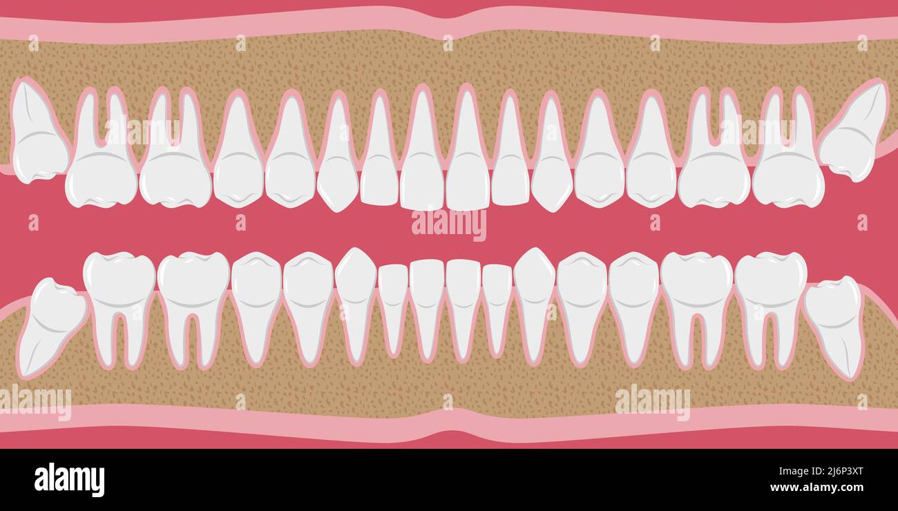 Healthy white human teeth in a row. Beautiful, even teeth with roots. The gums are cut to the bone. Structure of the jaw. Infographic elements for den Stock Vector