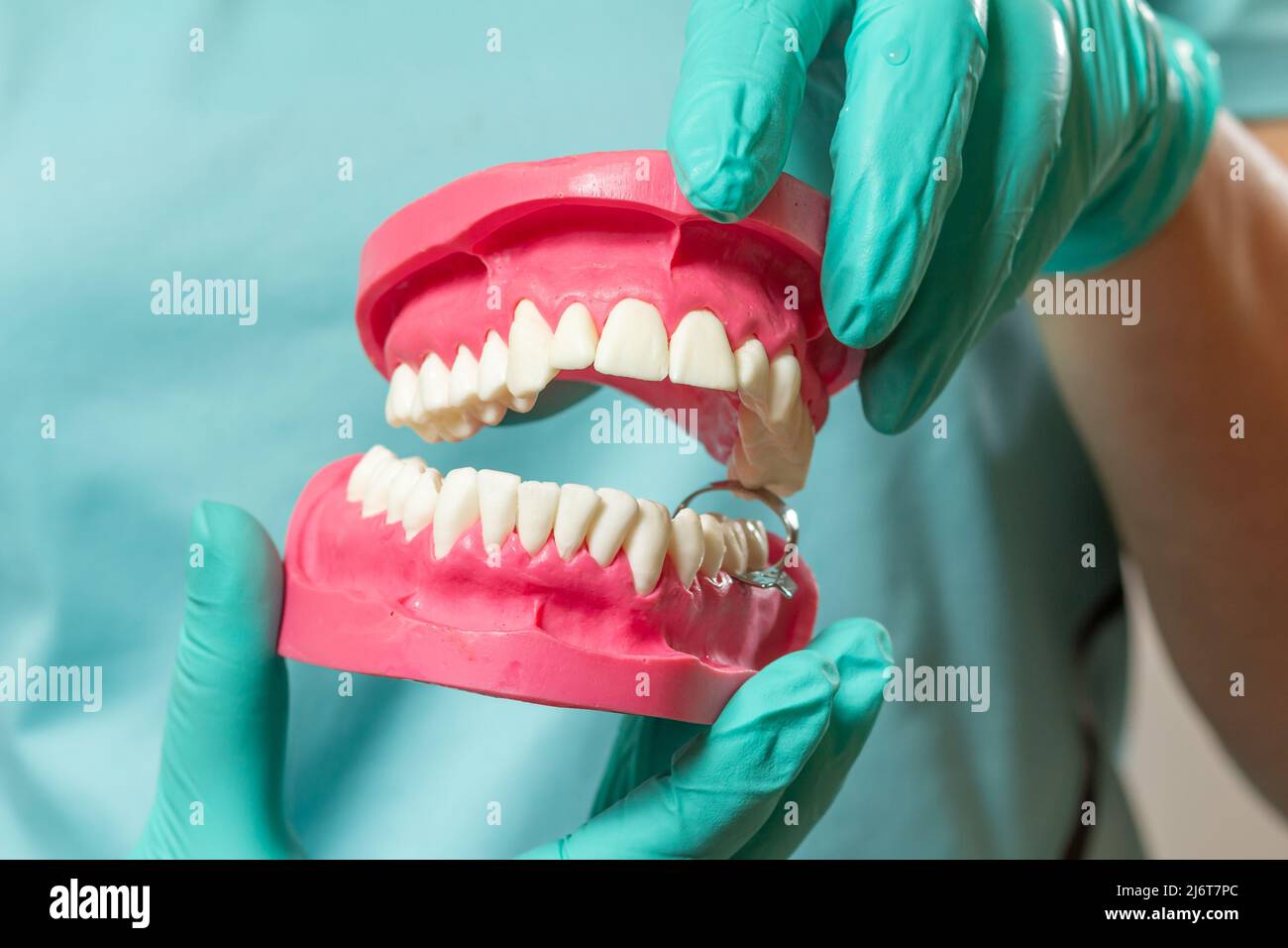 Dentist in latex gloves with a layout of the human jaw Stock Photo - Alamy
