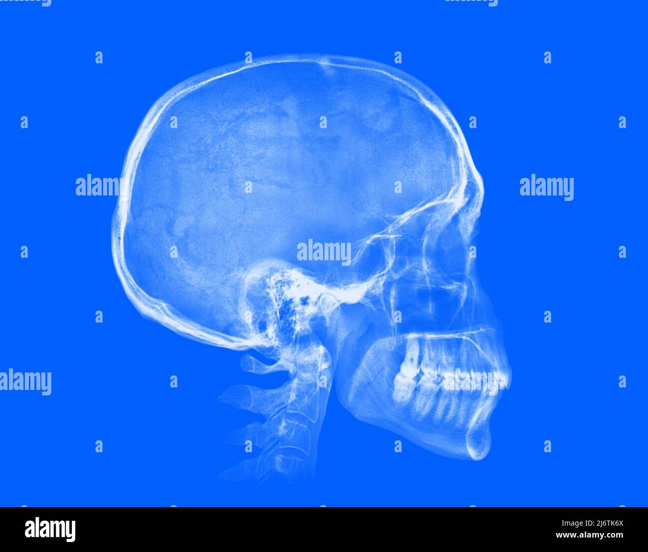 Human skull. Xray image isolated on blue background Stock Photo Alamy