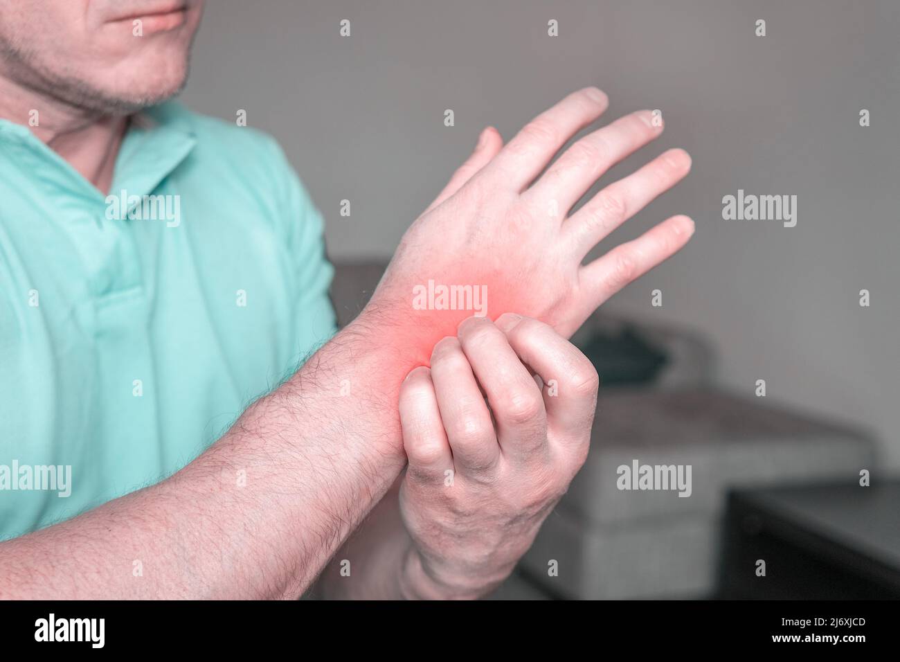 The concept of dermatitis, eczema, allergies, psoriasis. A man scratching an itchy hand. Close-up of a man with an itchy rash on his arm, the affected Stock Photo