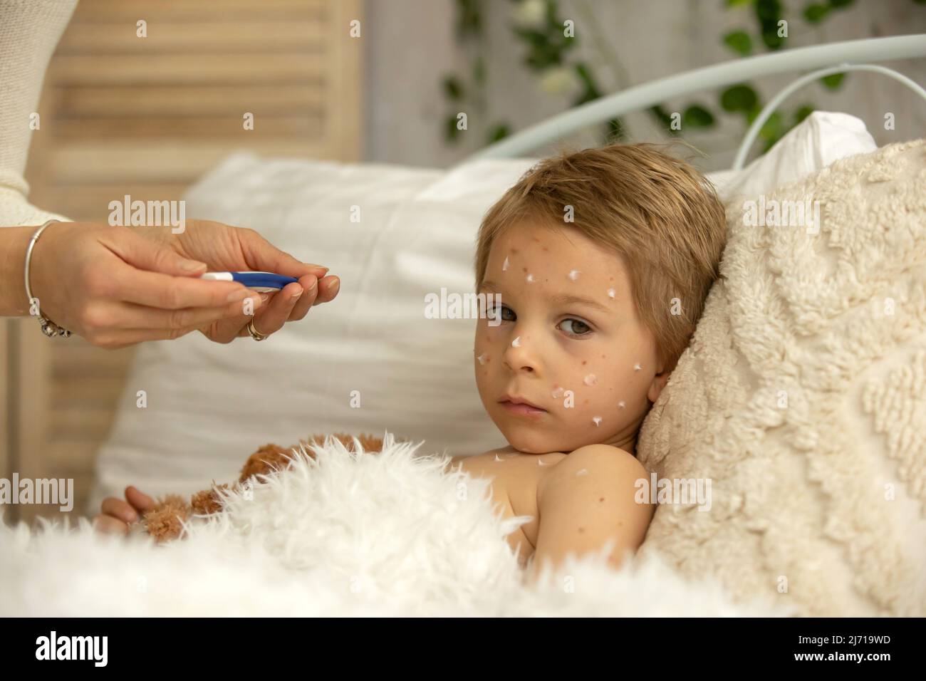 Toddler boy with chicken pox,lying in bed with fever, mother checking