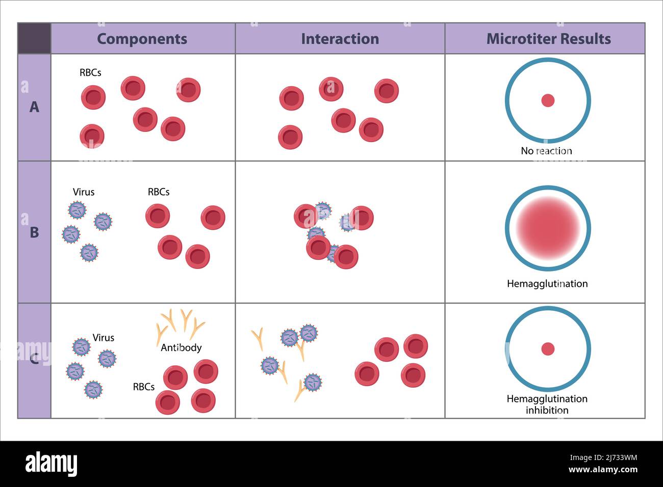 Possible outcomes of hemagglutination test. Agglutination of erythrocytes. The virus-specific antibodies inhibit agglutination. Stock Vector