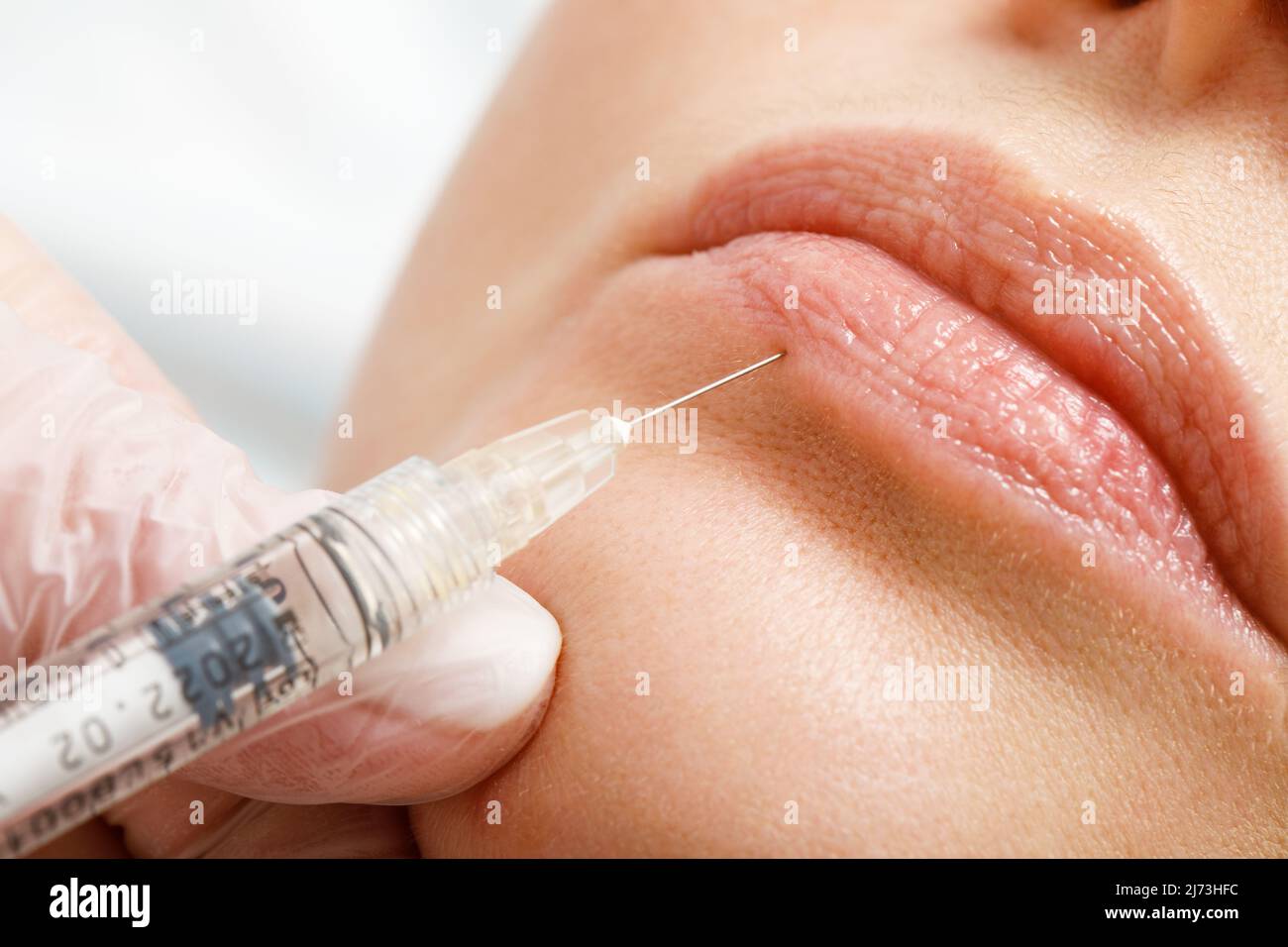 A woman makes lip shape correction in a cosmetology clinic. Lips injections, lip augmentation. Stock Photo