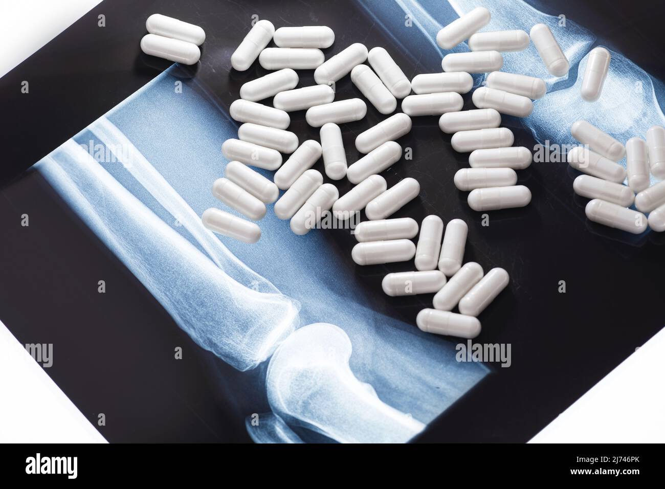 X-ray image and white capsules with dietary supplement or drug Stock Photo