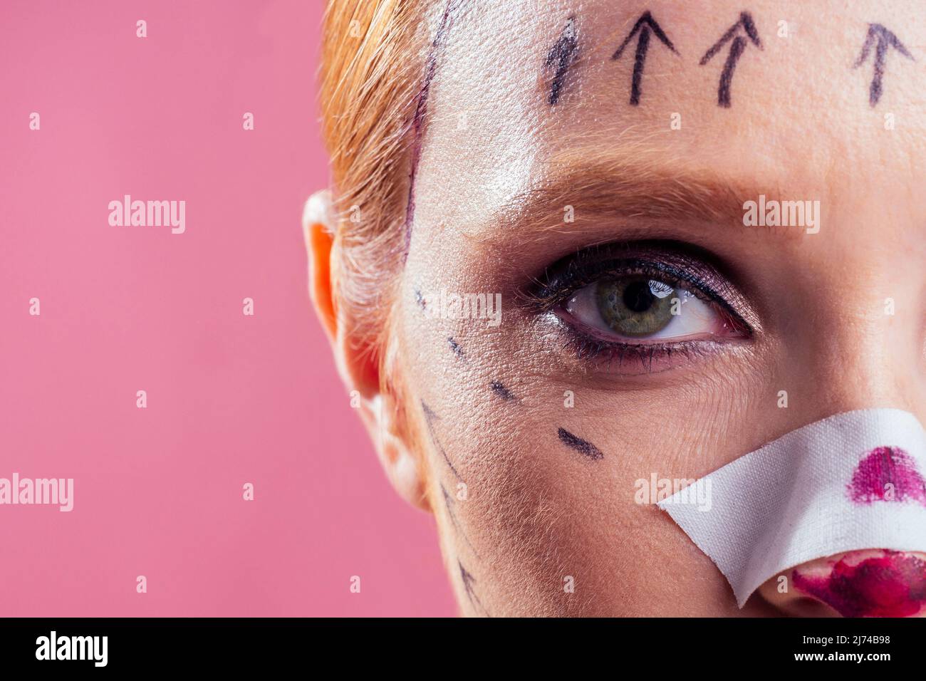 Patient in bandages. Nurses and young woman in studio pink background Stock Photo