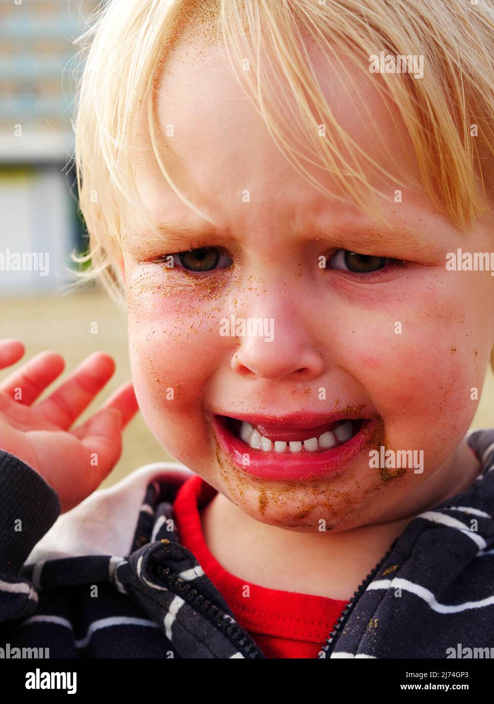 Swollen eyelids hires stock photography and images Alamy