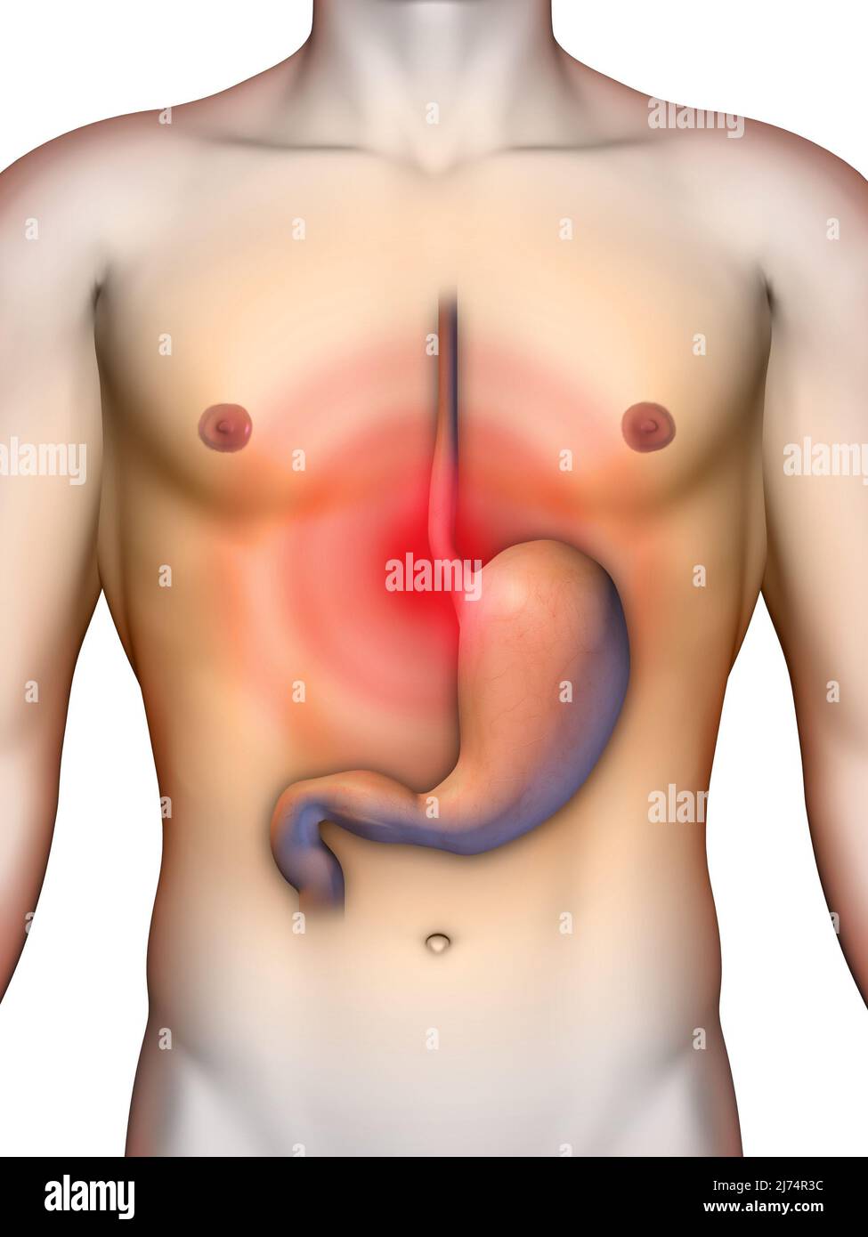 Acid reflux from stomach causing chest pain. Digital illustration, clipping path included. Stock Photo