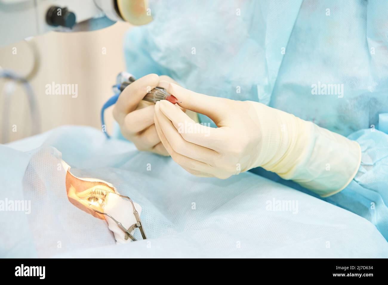 Ophthalmology laser microscope operation. Doctor surgery in clinic