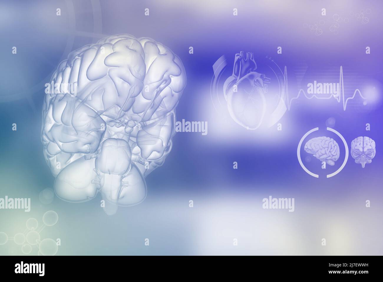 Head mri hi hi-res stock photography and images - Alamy