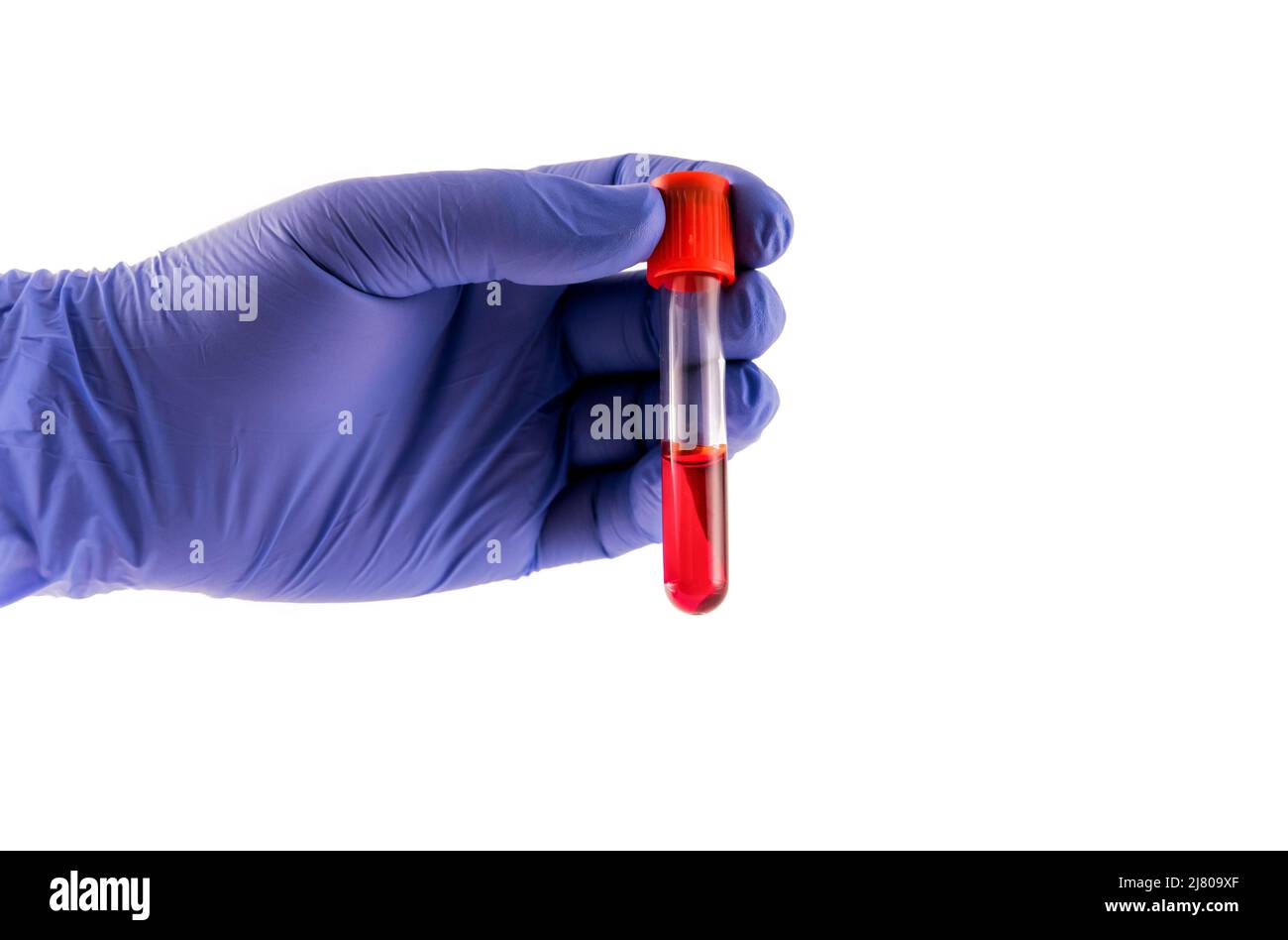 Test tube (Vacutainer) with blood in the hands of a researcher laboratory assistant, doctor. Stock Photo