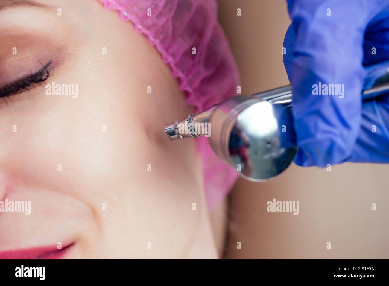 woman getting facial massage with oxy air spray .oxygen therapy in spa salon.close up cheek face of patient Stock Photo