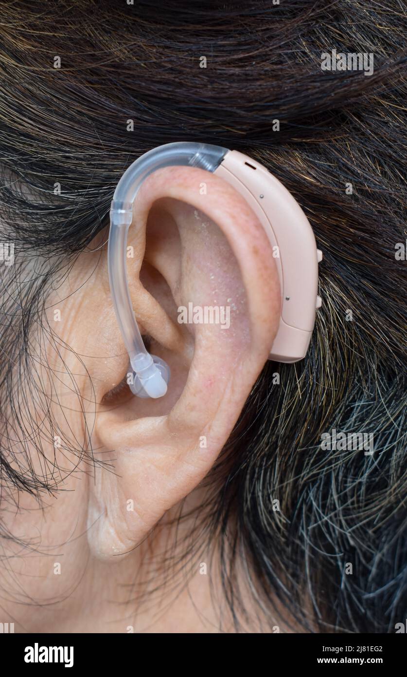 Electronic hearing aid device in the ear of Asian old woman with total deafness. Stock Photo