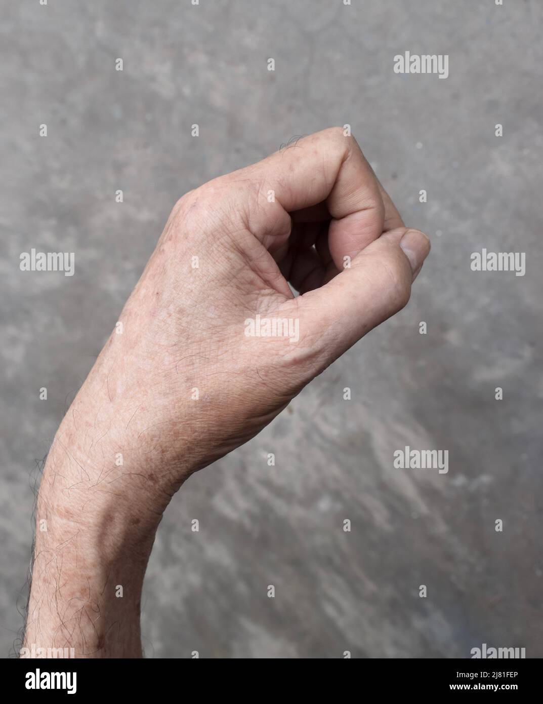 Hand muscle rigidity and finger flexion of Asian elder man. Stock Photo