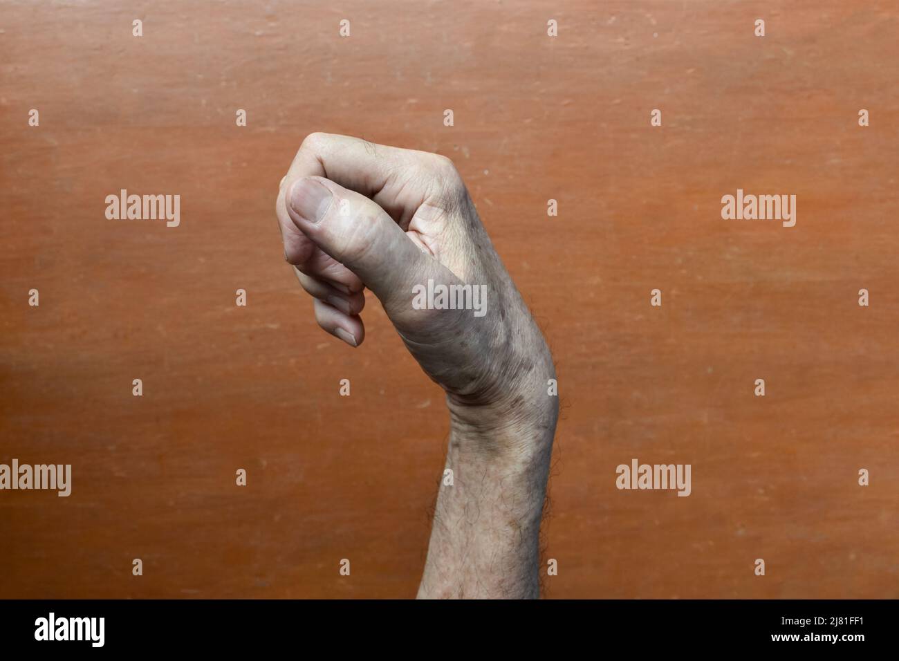 Hand muscle rigidity and finger flexion of Asian elder man. Stock Photo
