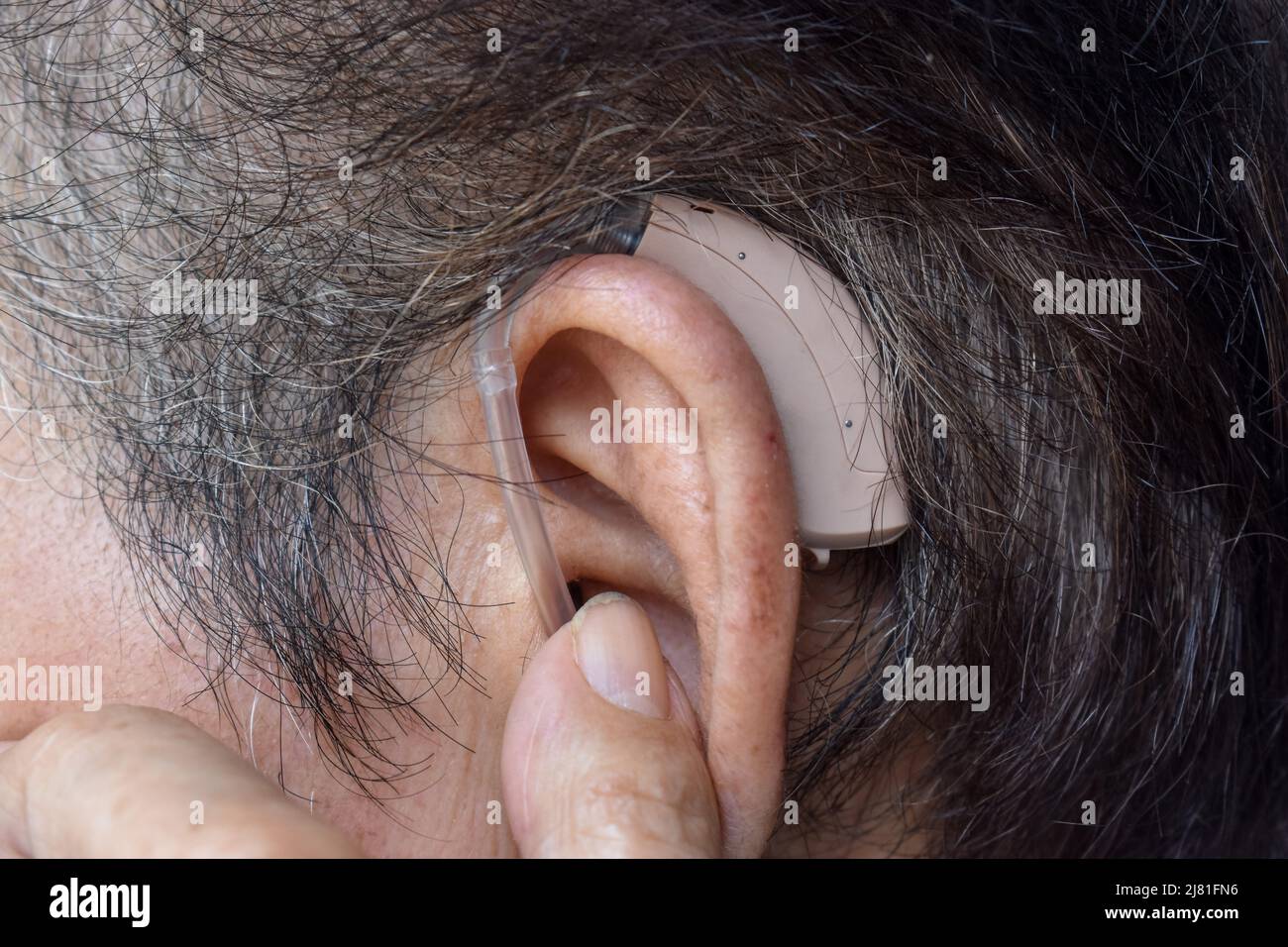 Electronic hearing aid device in the ear of Asian old man with total deafness. Stock Photo