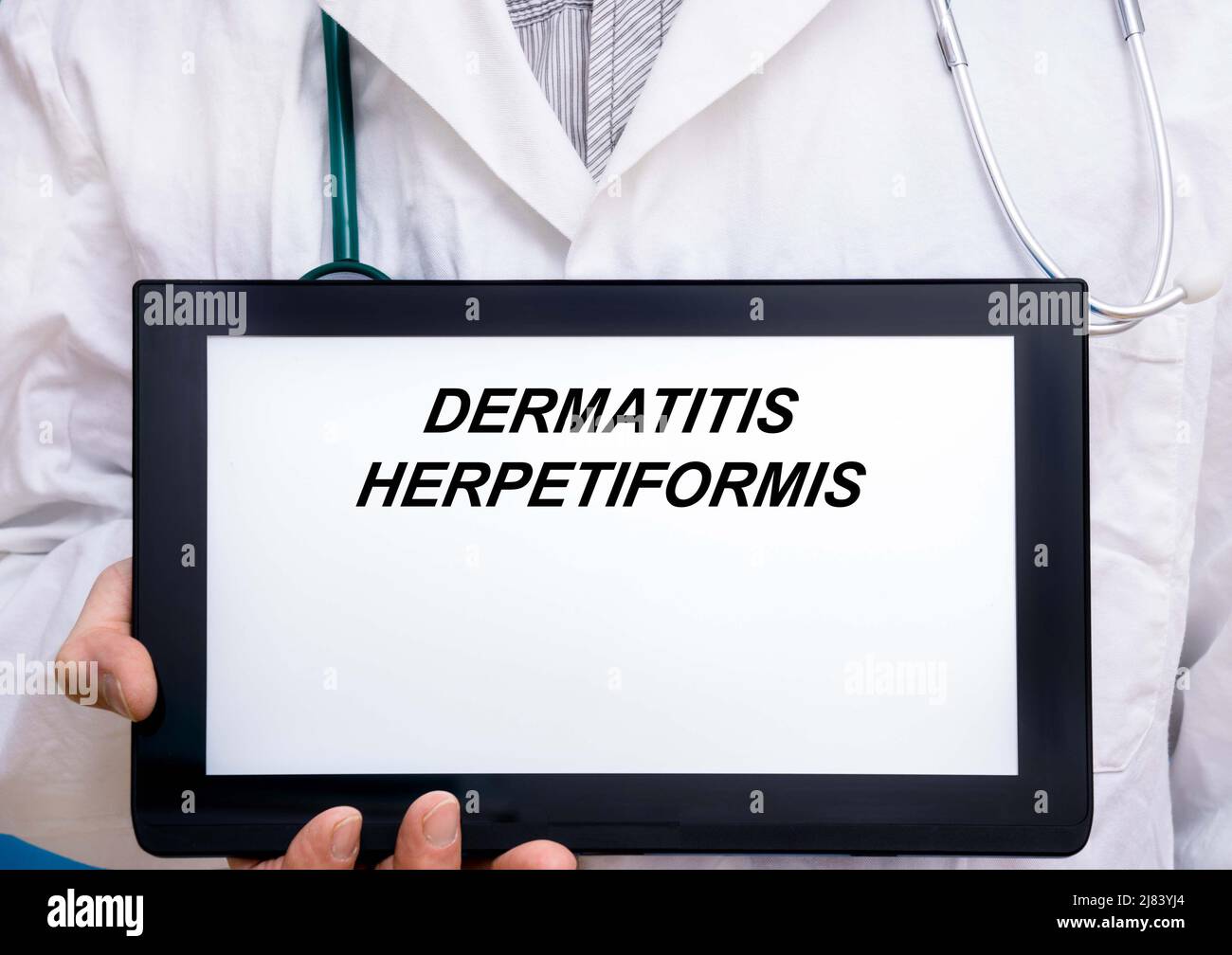 Dermatitis Herpetiformis.  Doctor with rare or orphan disease text on tablet screen Dermatitis Herpetiformis Stock Photo