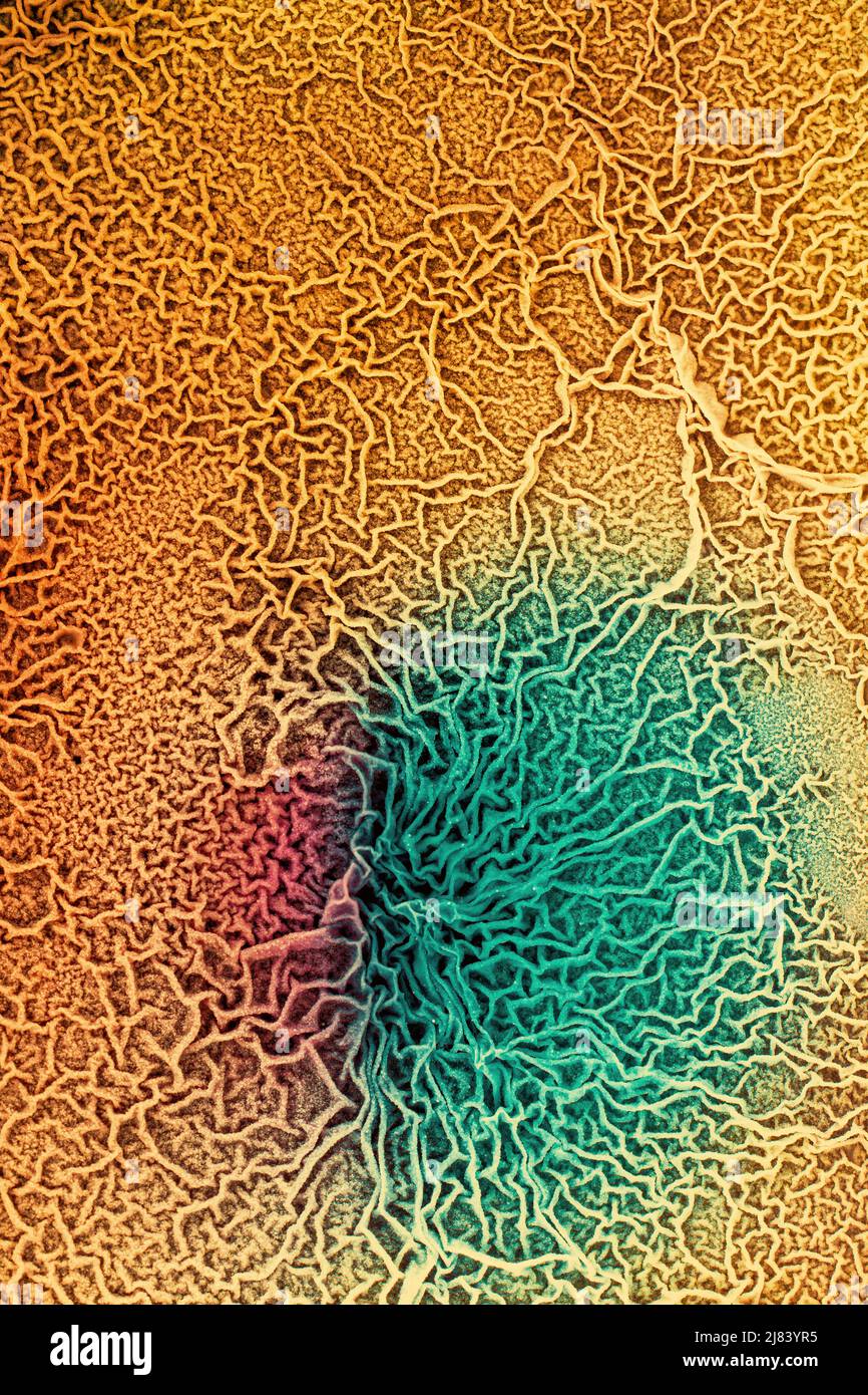 The tissue of a biological organism is affected by two types of cancer cells. Electron microscopy. Concept image of mutational processes under the inf Stock Photo
