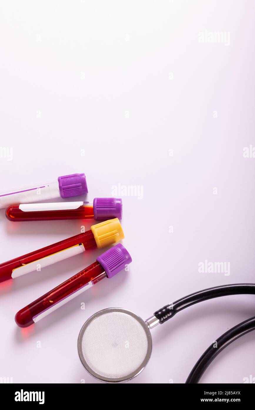 Overhead view of test tubes with blood samples and stethoscope on white ...