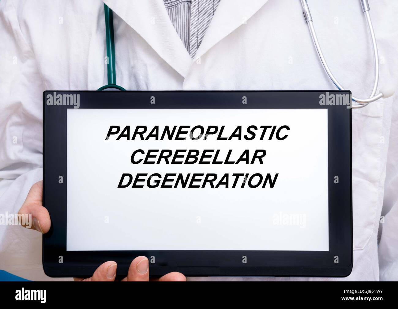 Paraneoplastic Cerebellar Degeneration.  Doctor with rare or orphan disease text on tablet screen Paraneoplastic Cerebellar Degeneration Stock Photo