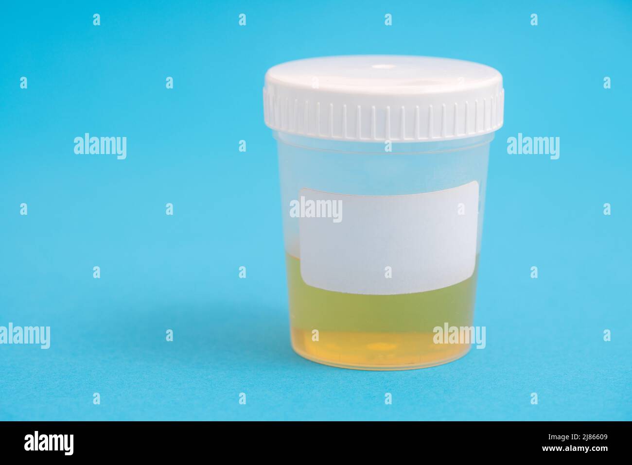 container with a urine sample for laboratory analysis Stock Photo - Alamy