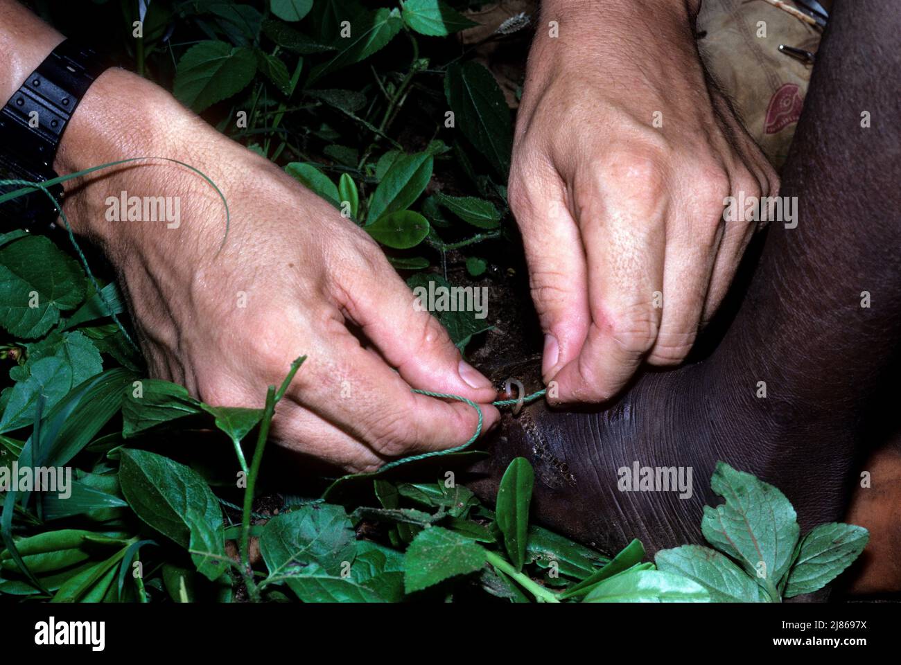Guinea worm (Dracunculus medinensis), Benin. Stock Photo